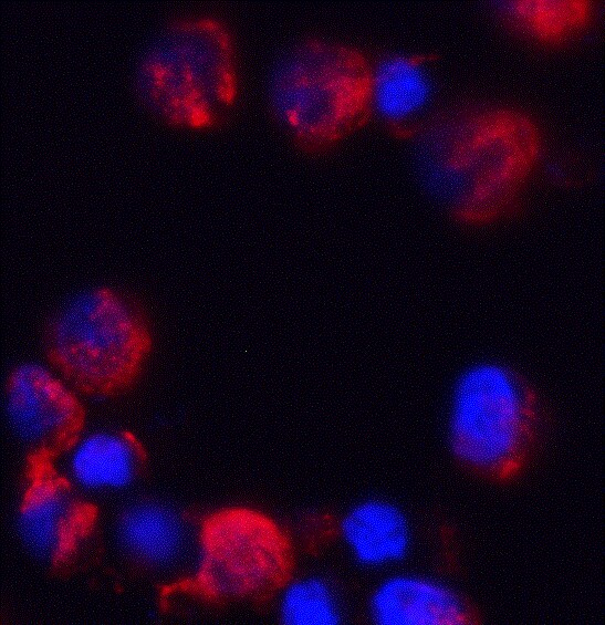 AKAIN1 Antibody - BSA Free