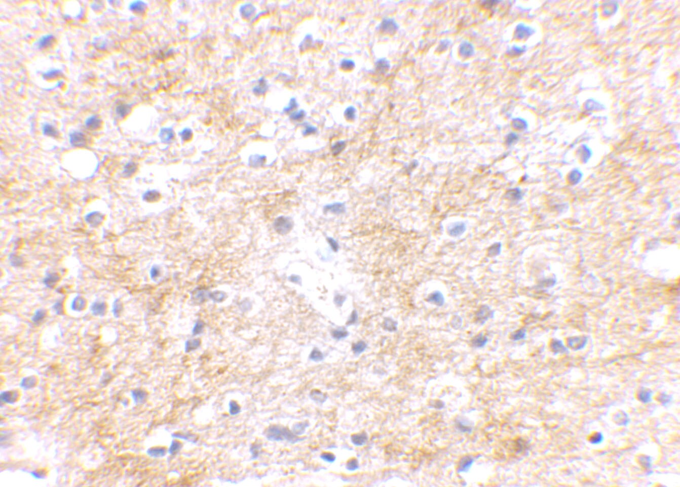 DLGAP3 Antibody - BSA Free