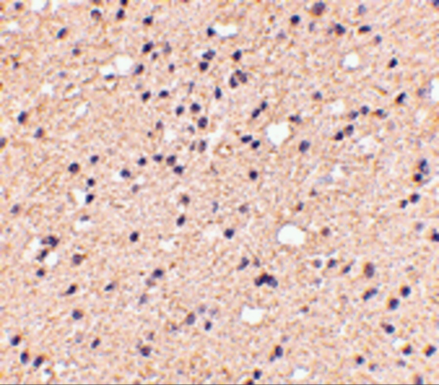 ELOVL6 Antibody - BSA Free