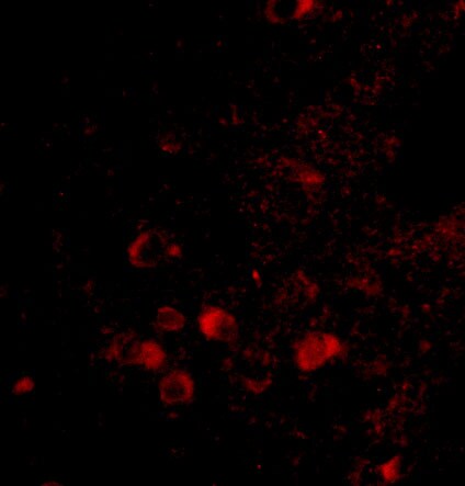 ELOVL6 Antibody - BSA Free