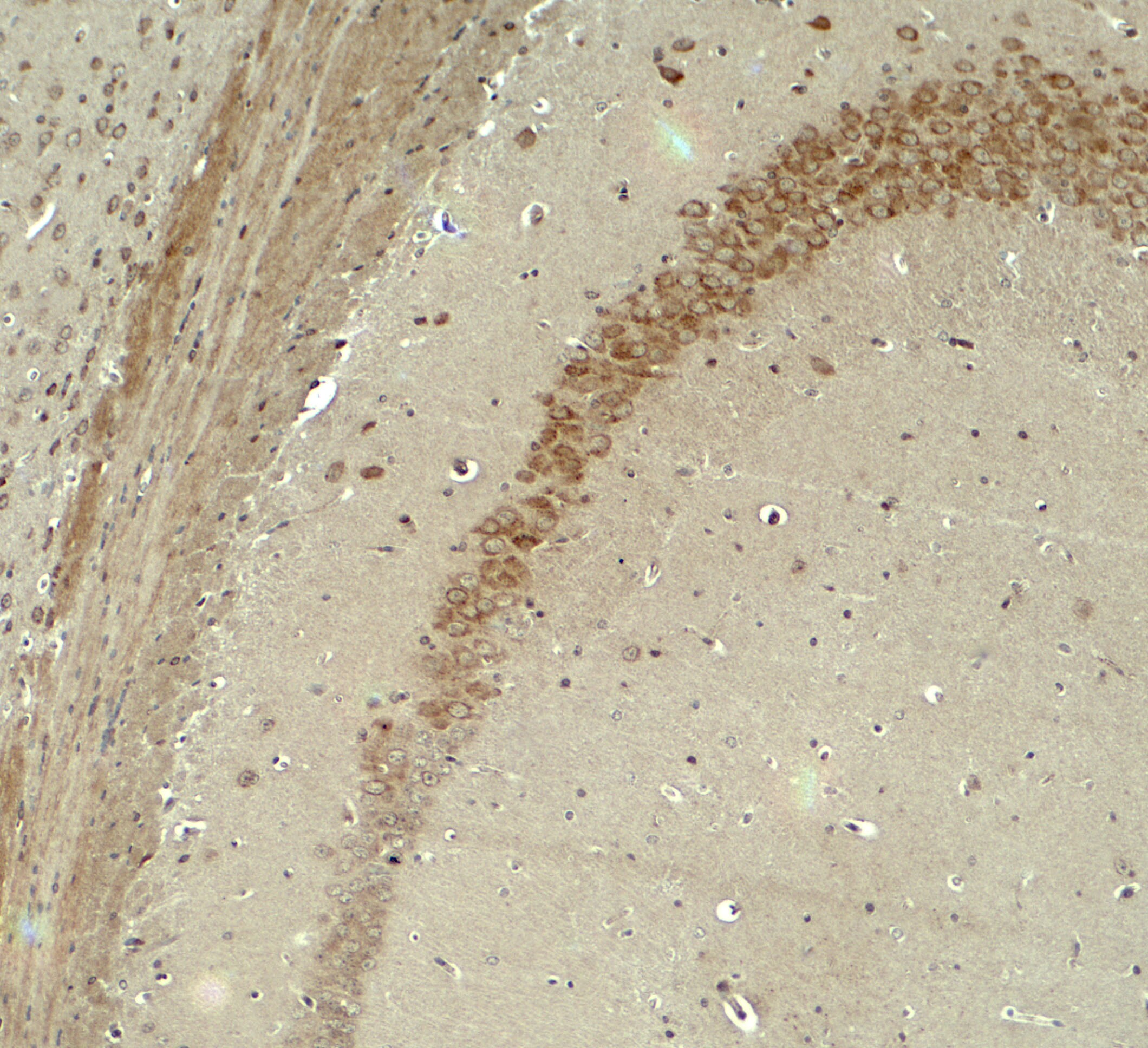IQSEC2 Antibody - BSA Free