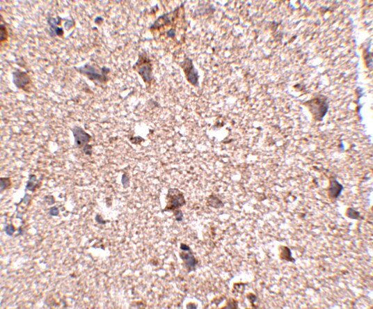 JPH3 Antibody - BSA Free