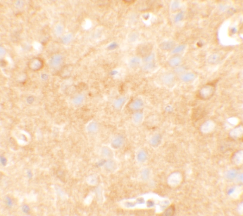 KCNK12 Antibody - BSA Free