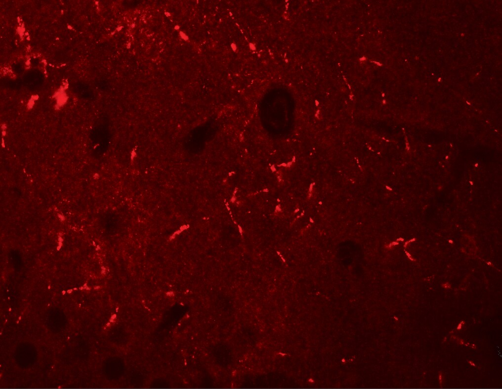 KCNK12 Antibody - BSA Free