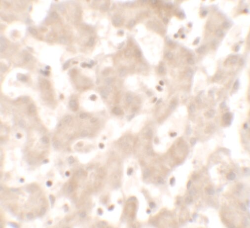 KHDC1 Antibody - BSA Free