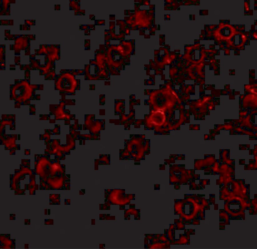 LRFN2 Antibody - BSA Free
