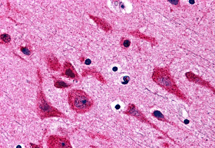 TAB2 Antibody - BSA Free