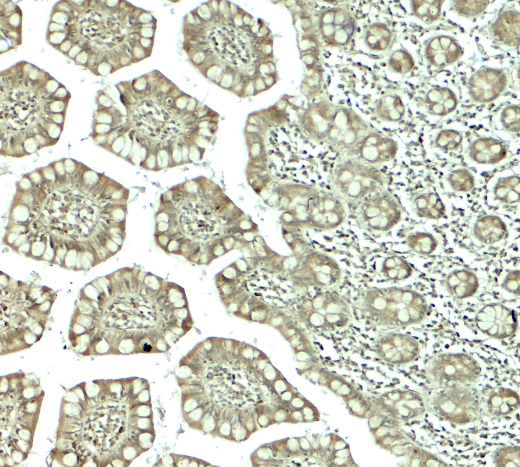 CTHRC1 Antibody - BSA Free