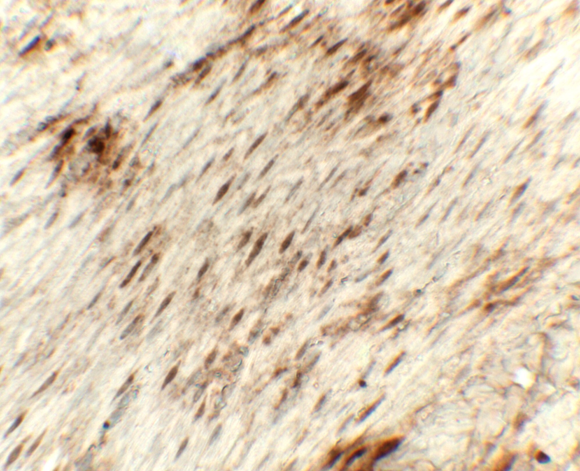 Golgin 97 Antibody - BSA Free
