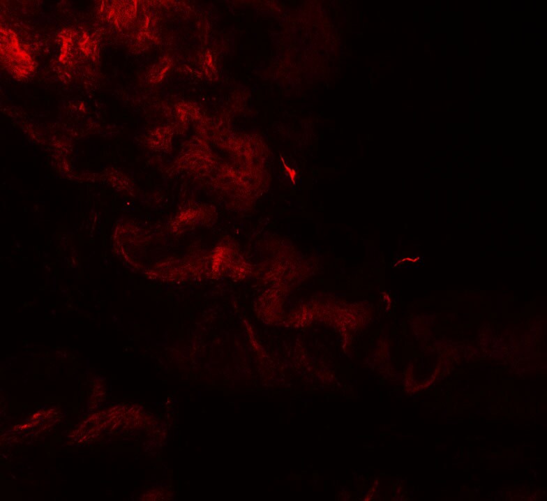 Golgin 97 Antibody - BSA Free