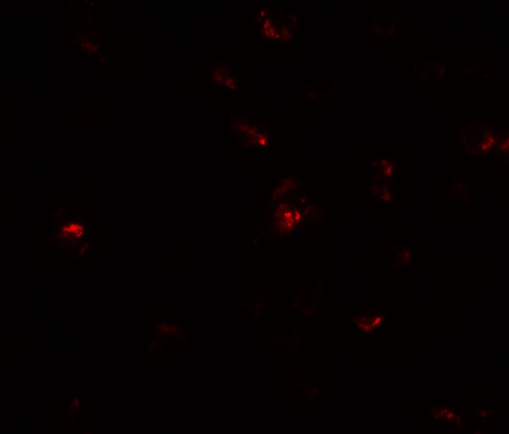 Transglutaminase 7/TGM7 Antibody - BSA Free