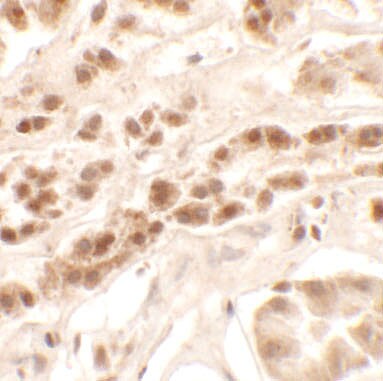 Patched Domain Containing 2 Antibody - BSA Free