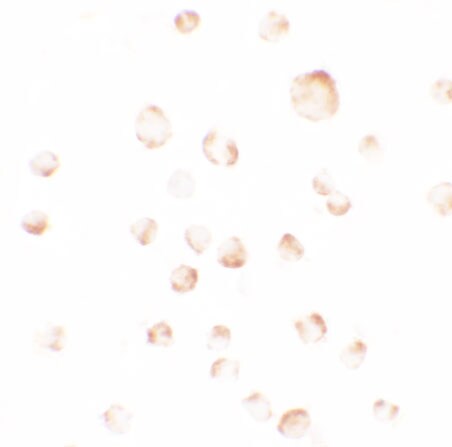 PHLPP Antibody - BSA Free