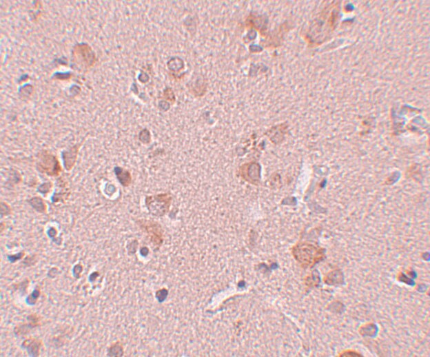 PLEKHM3 Antibody - BSA Free