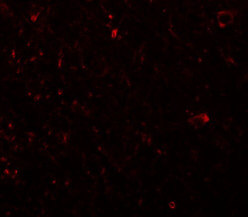 PLEKHM3 Antibody - BSA Free