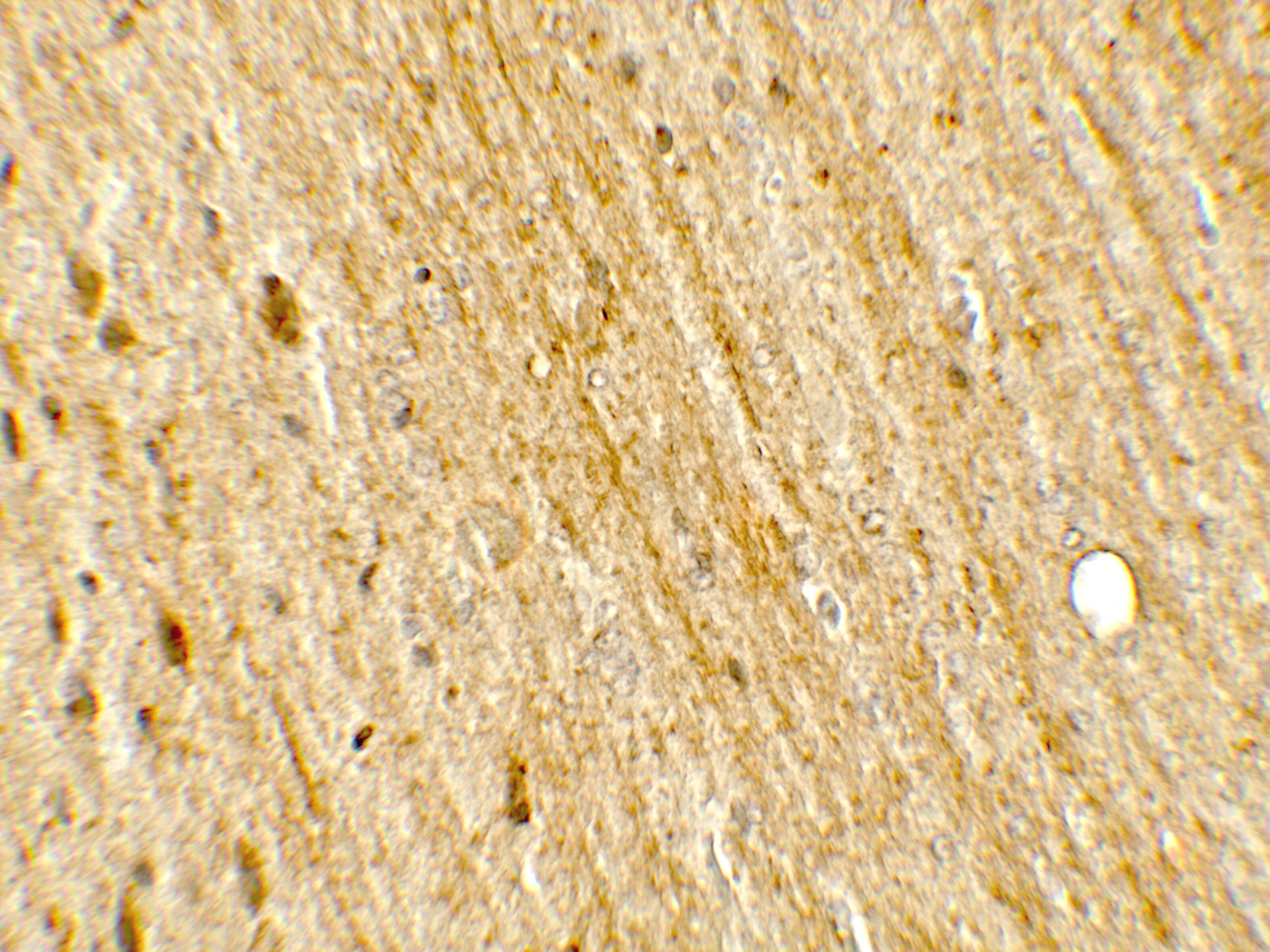 POU2F3 Antibody - BSA Free