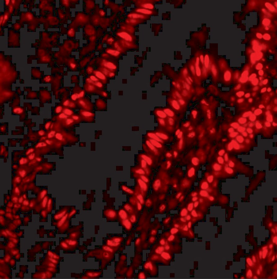 ANP32A Antibody - BSA Free