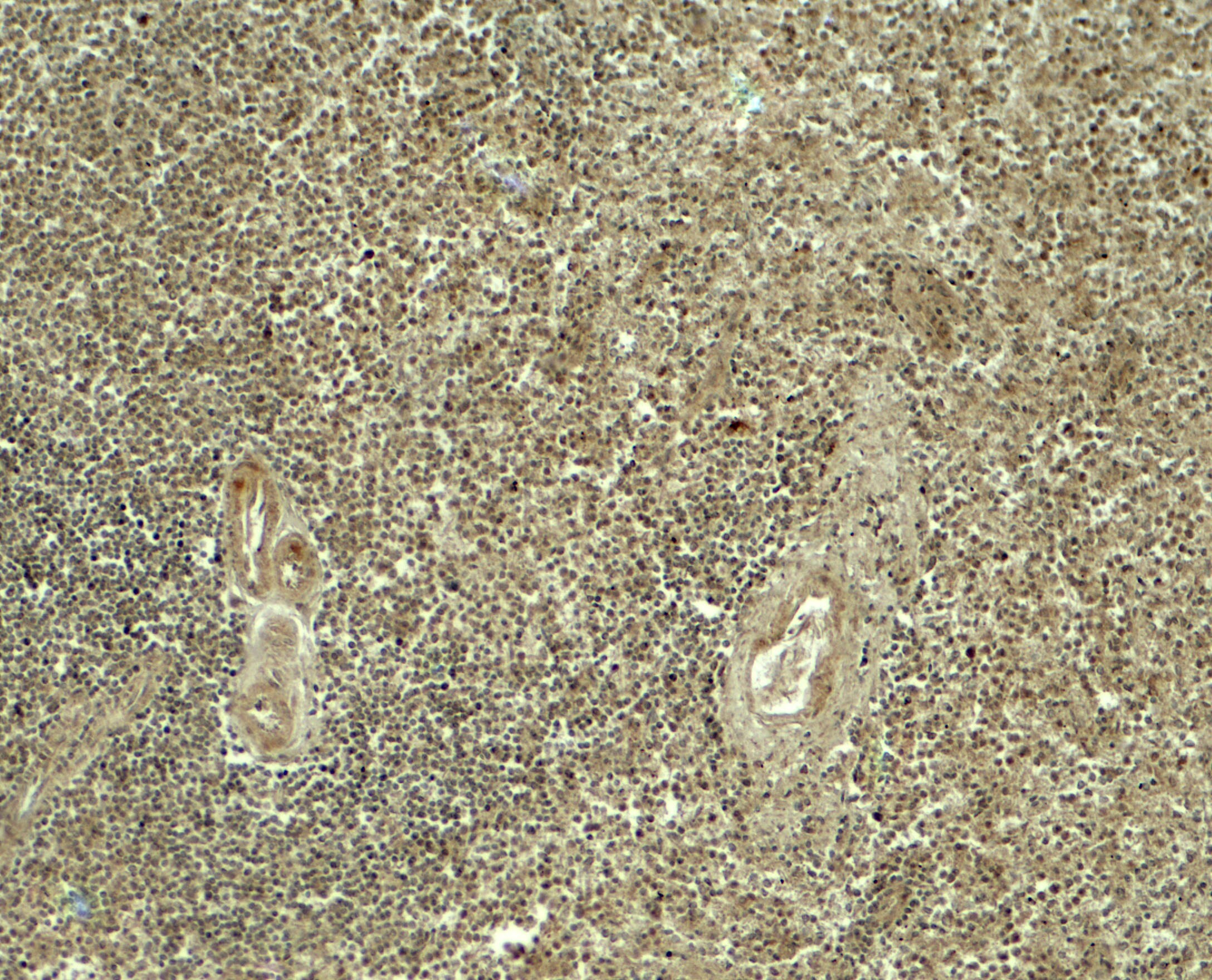 ATG4A Antibody - BSA Free