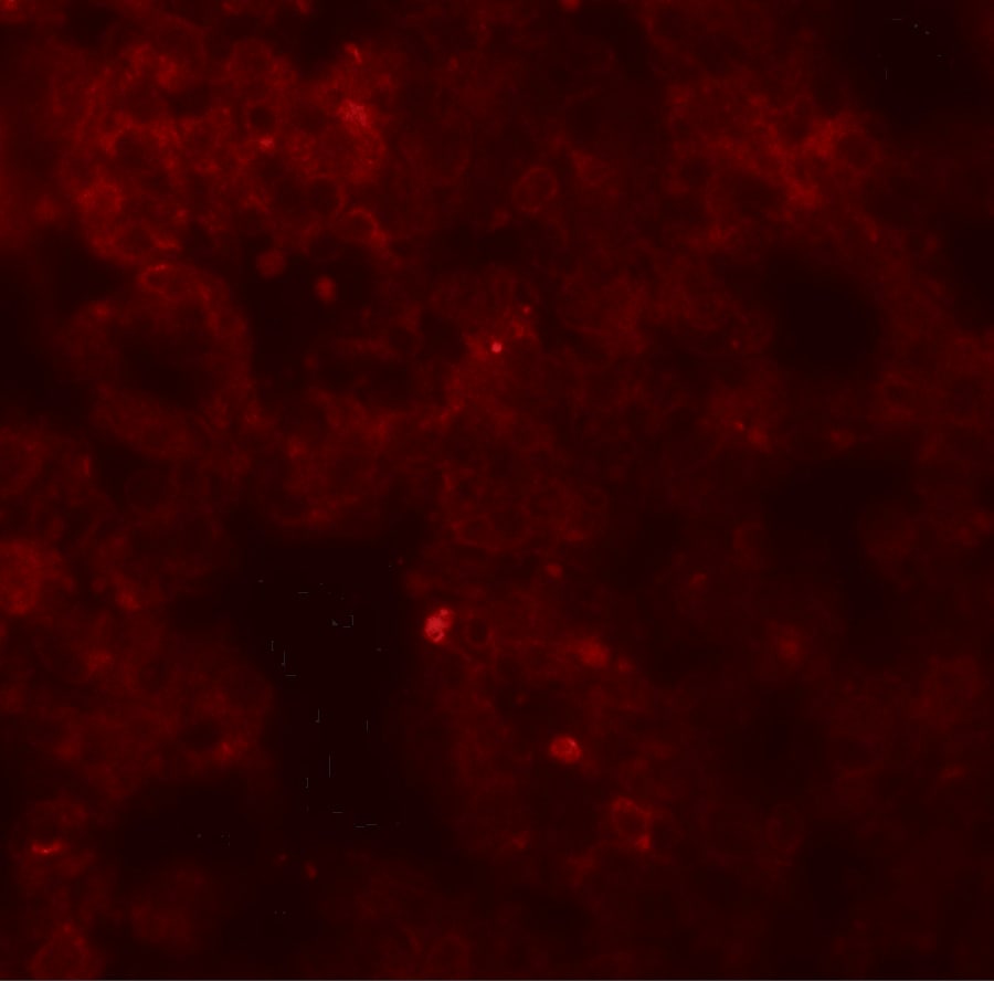CORO7 Antibody - BSA Free
