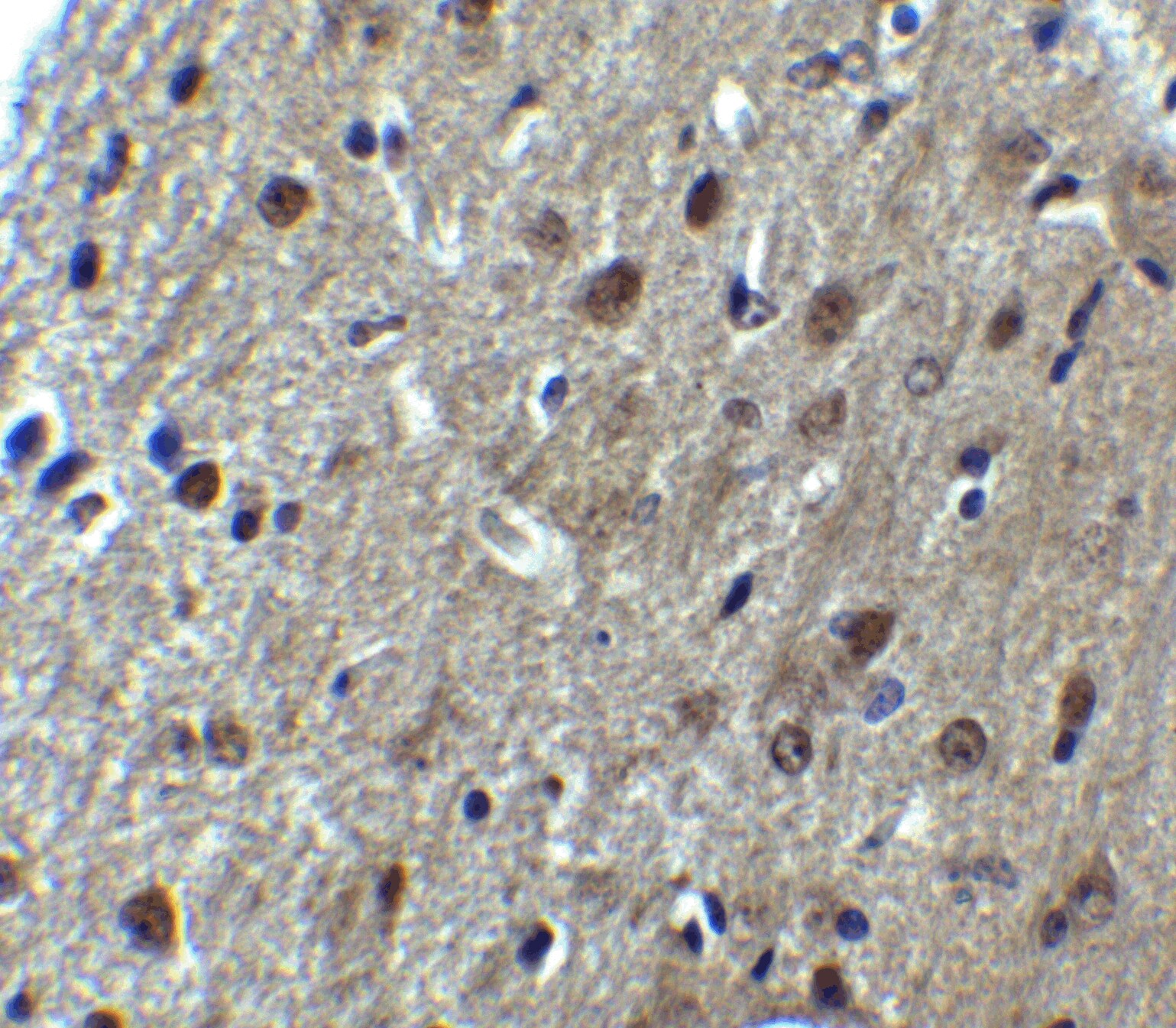 ARID1A Antibody - BSA Free