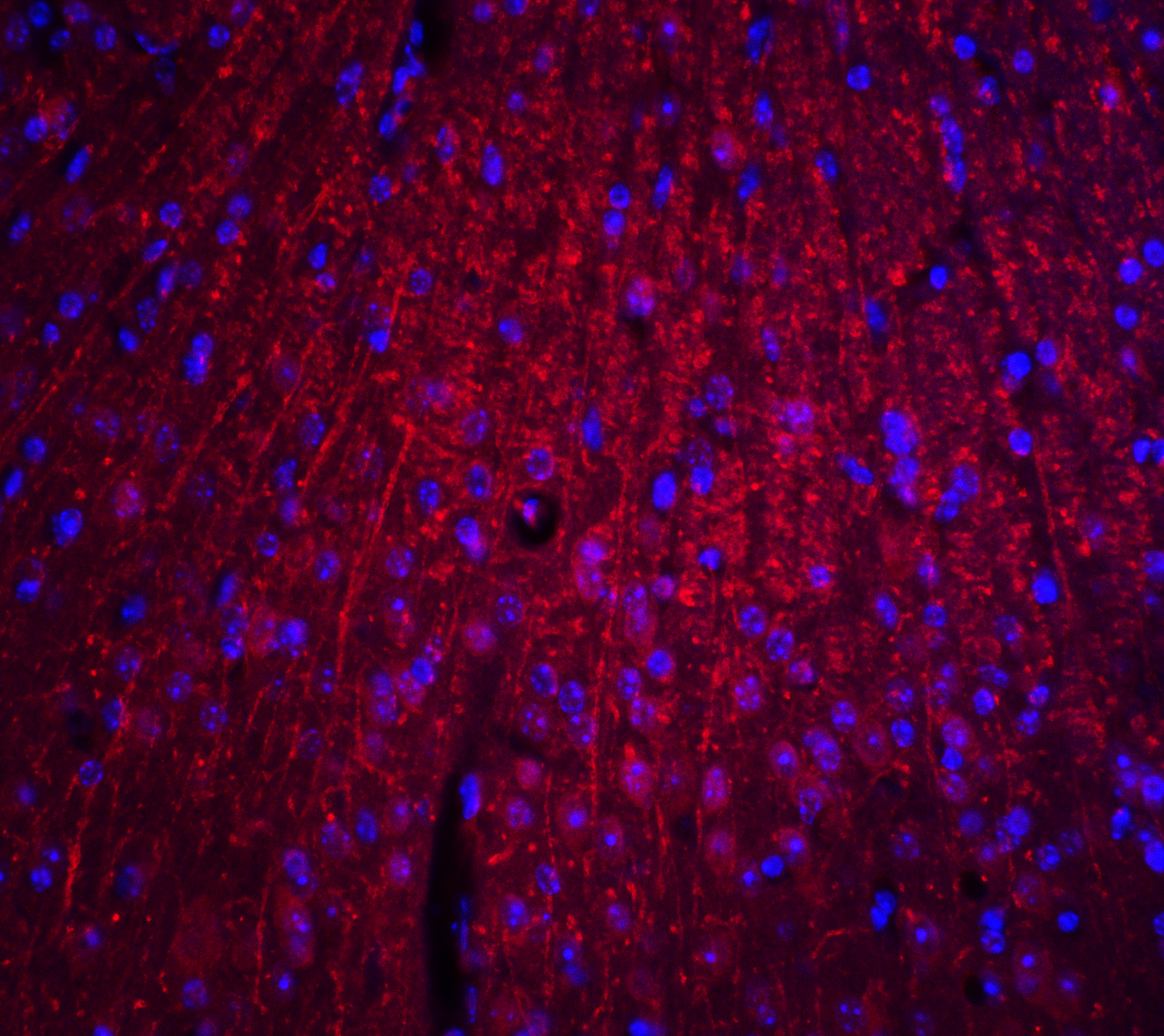 ARID1A Antibody - BSA Free