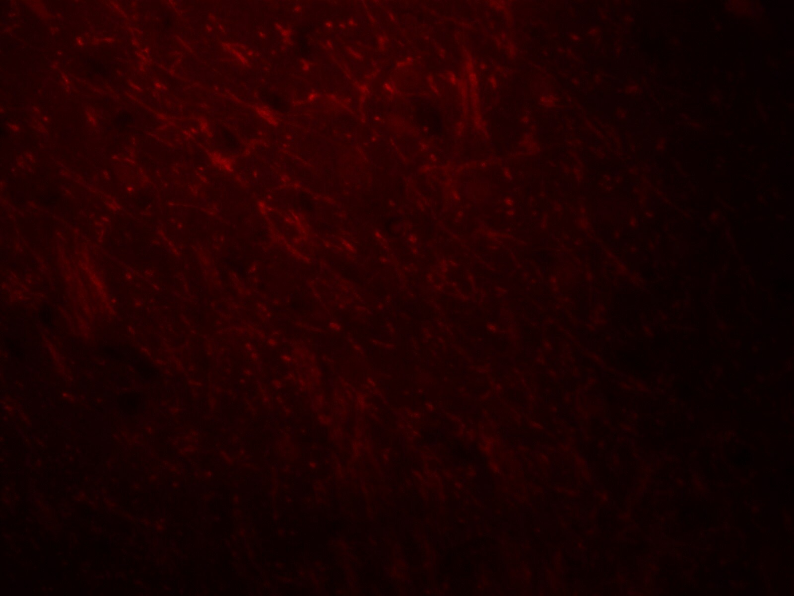 ARID1A Antibody - BSA Free