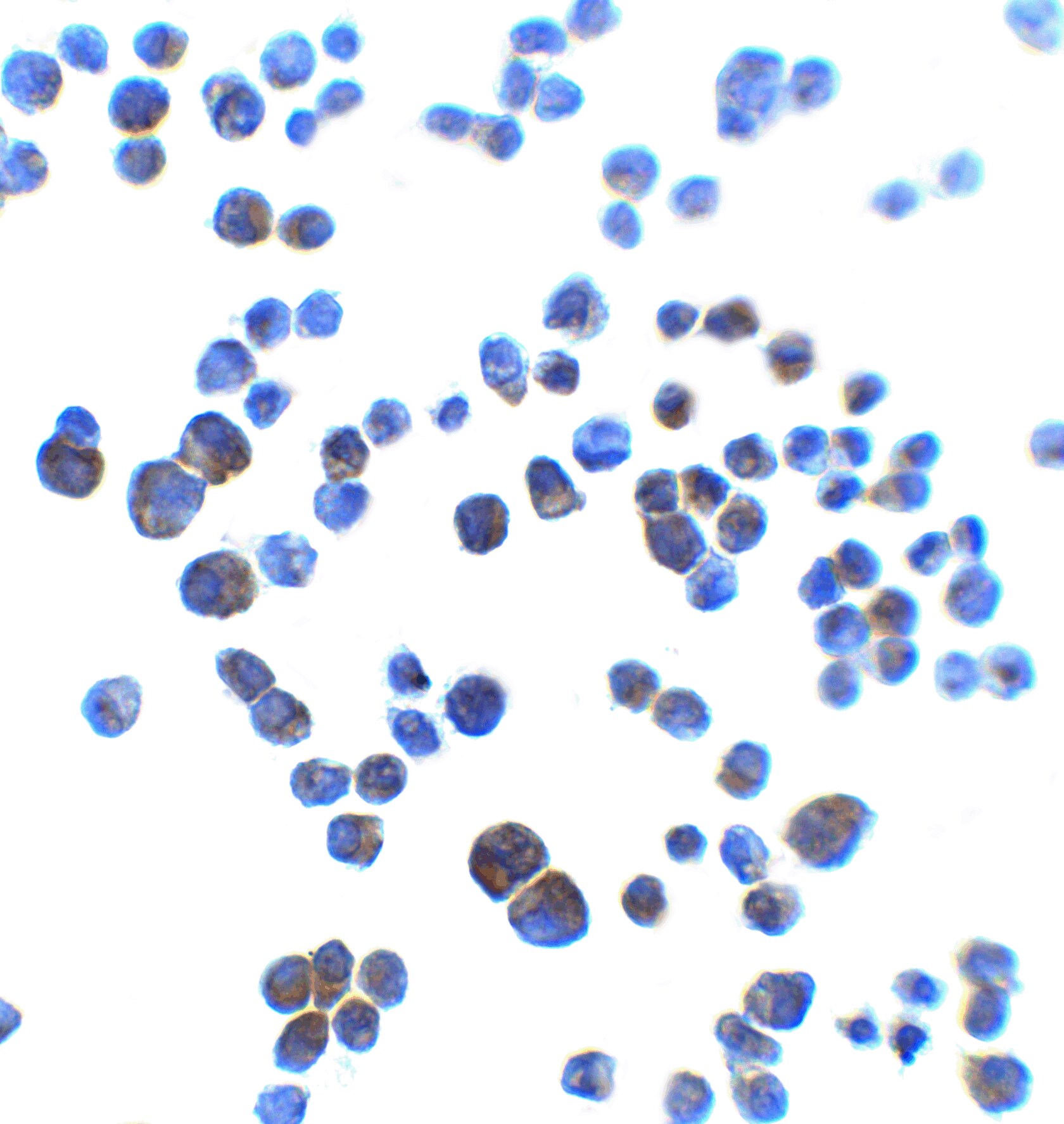 Shrew-1/AJAP1 Antibody - BSA Free