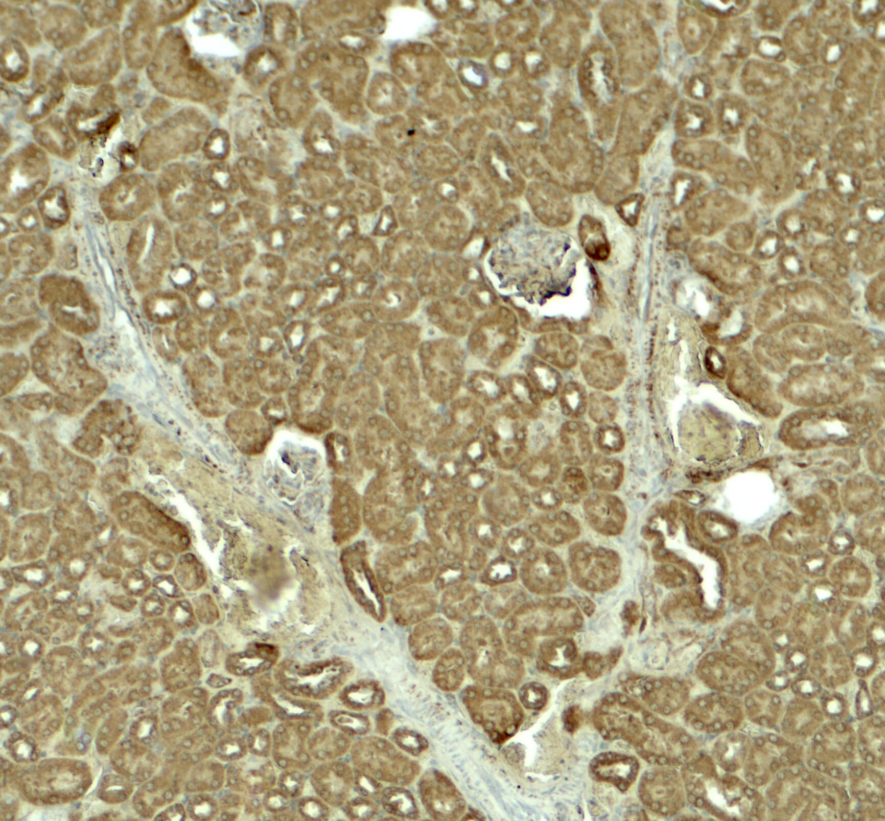 SLC1A7 Antibody - BSA Free