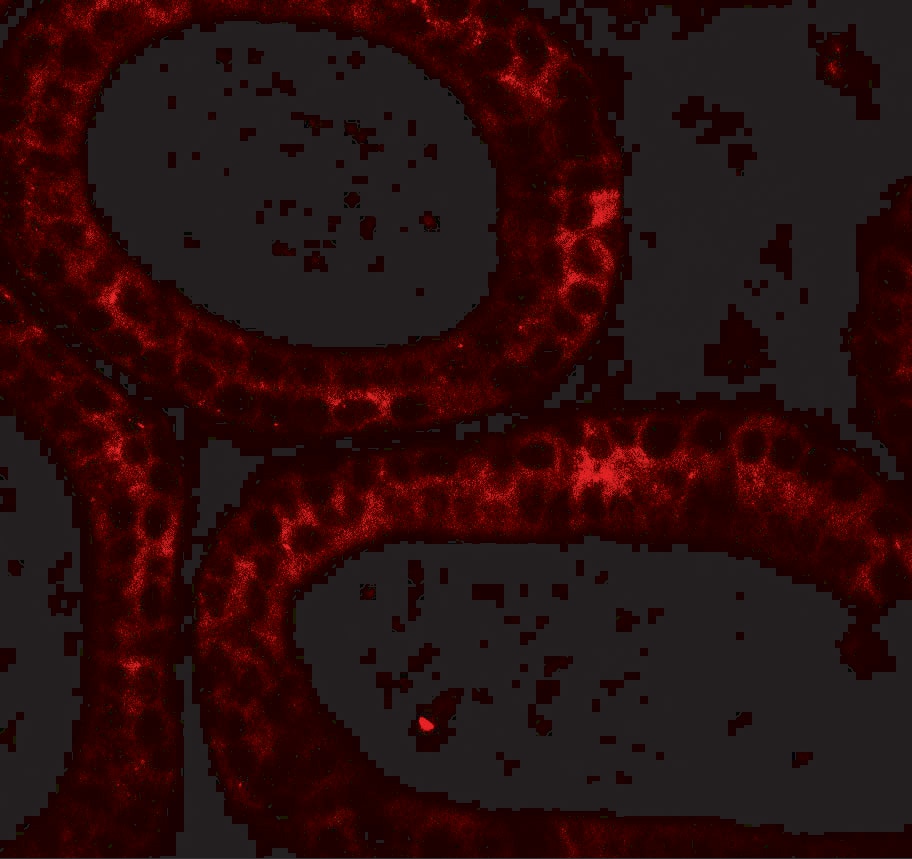 DIS3 Antibody - BSA Free