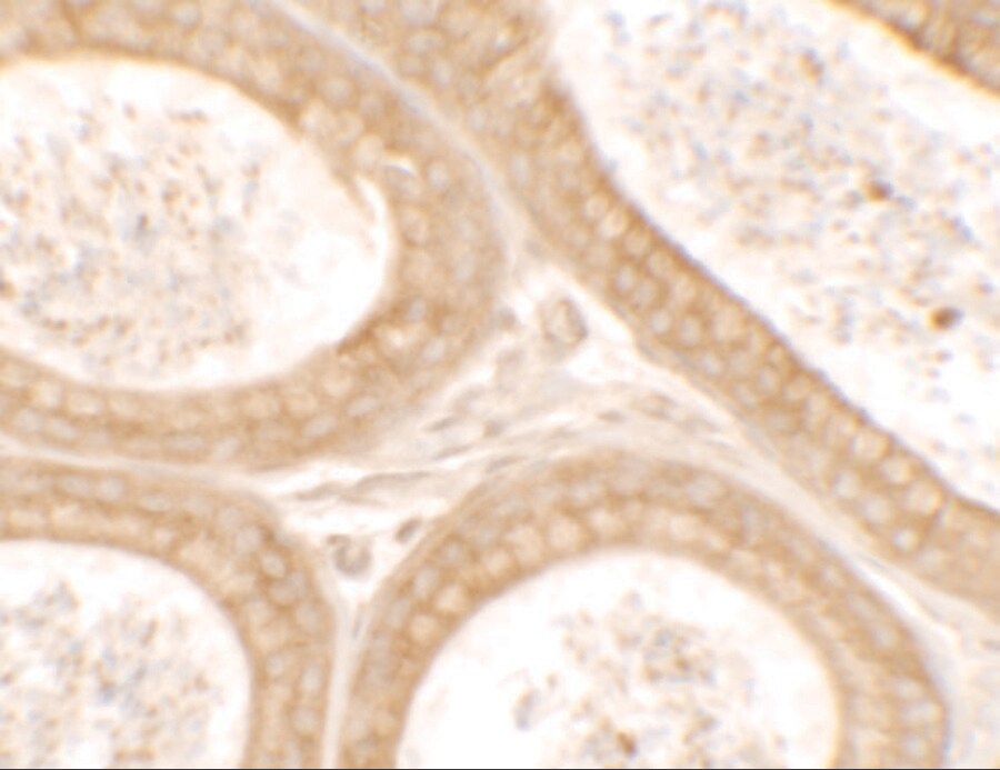 DIS3 Antibody - BSA Free