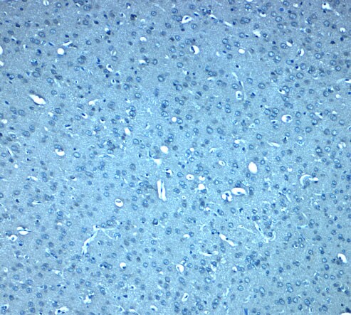 DIS3L2 Antibody - BSA Free