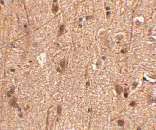 SLITRK3 Antibody - BSA Free