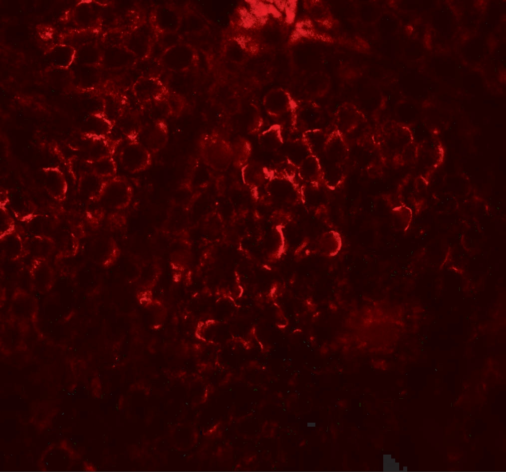 DCP2 Antibody - BSA Free