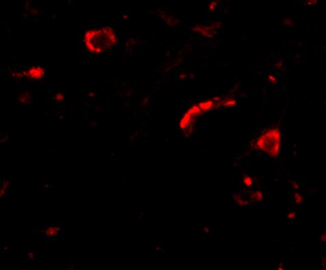SLITRK3 Antibody - BSA Free