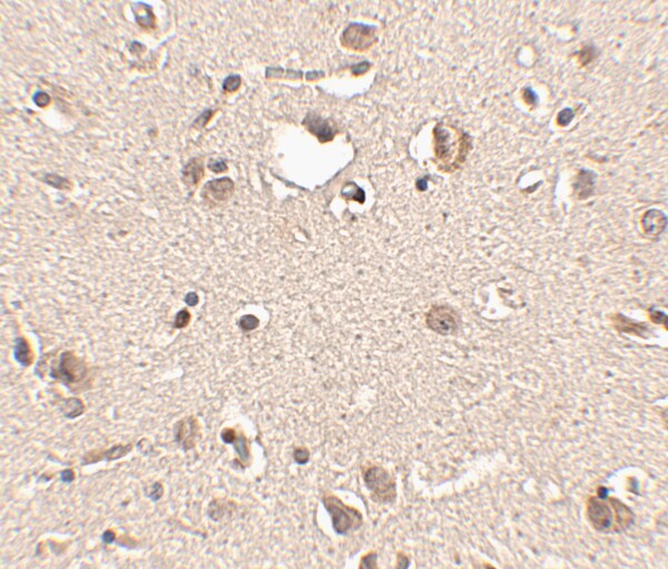 SLITRK3 Antibody - BSA Free