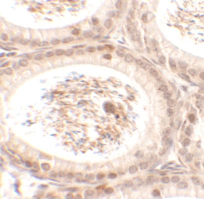 SPATA3 Antibody - BSA Free