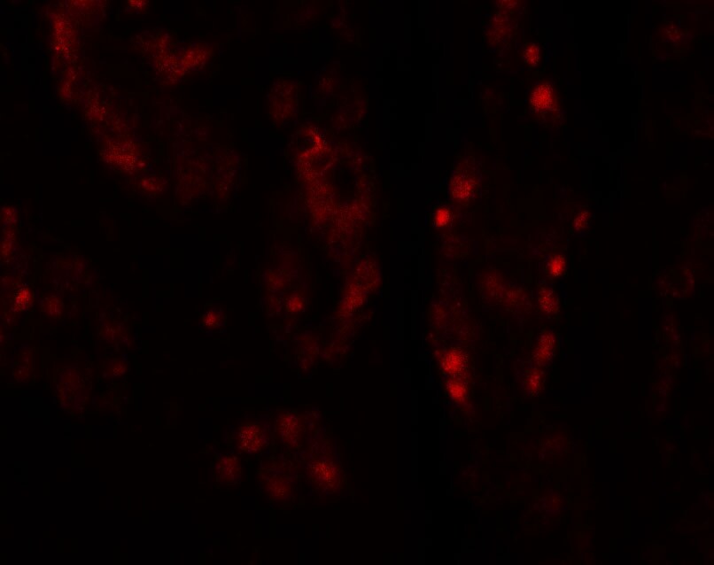 DISP1 Antibody - BSA Free