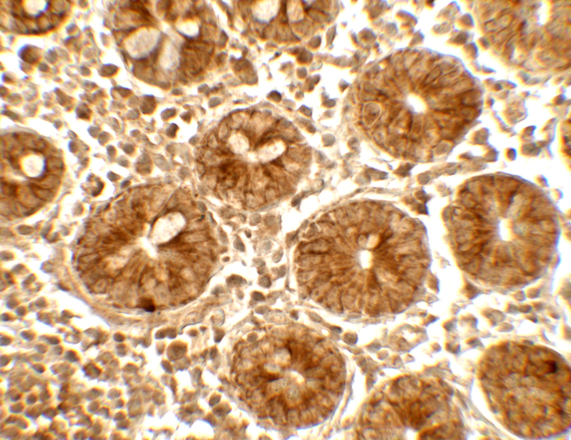 IFIT1 Antibody - BSA Free