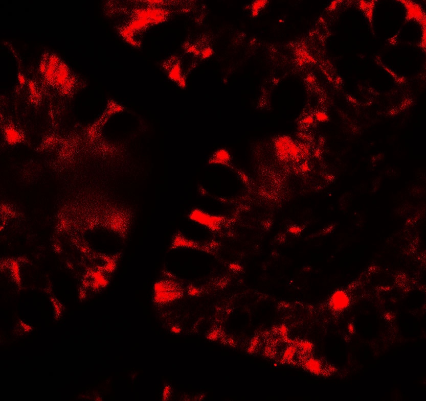 IFIT1 Antibody - BSA Free