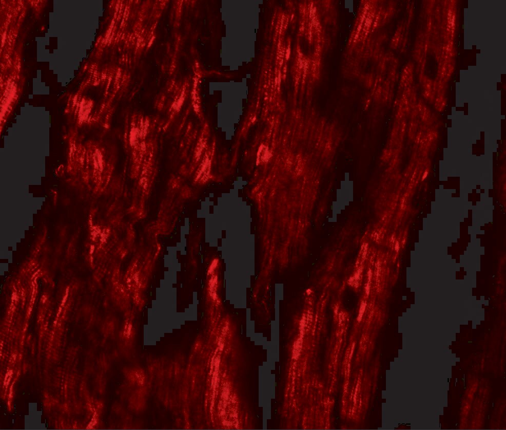 ERR beta/NR3B2 Antibody - BSA Free