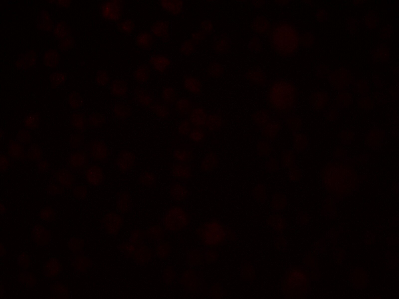 SLAIN1 Antibody - BSA Free