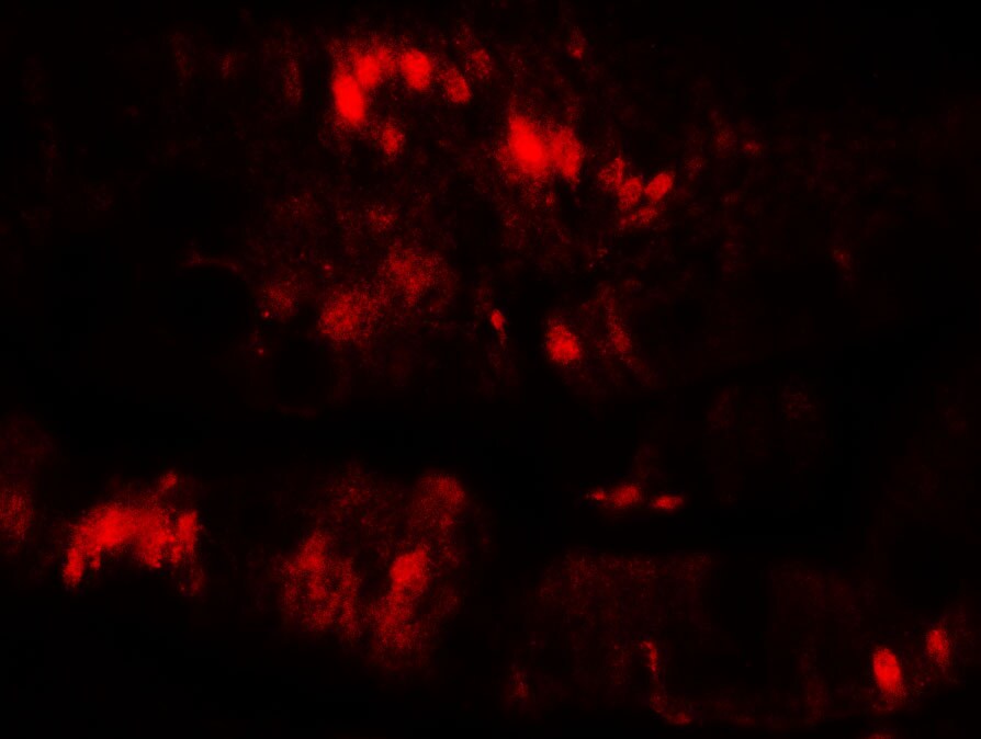 SLC29A3 Antibody - BSA Free
