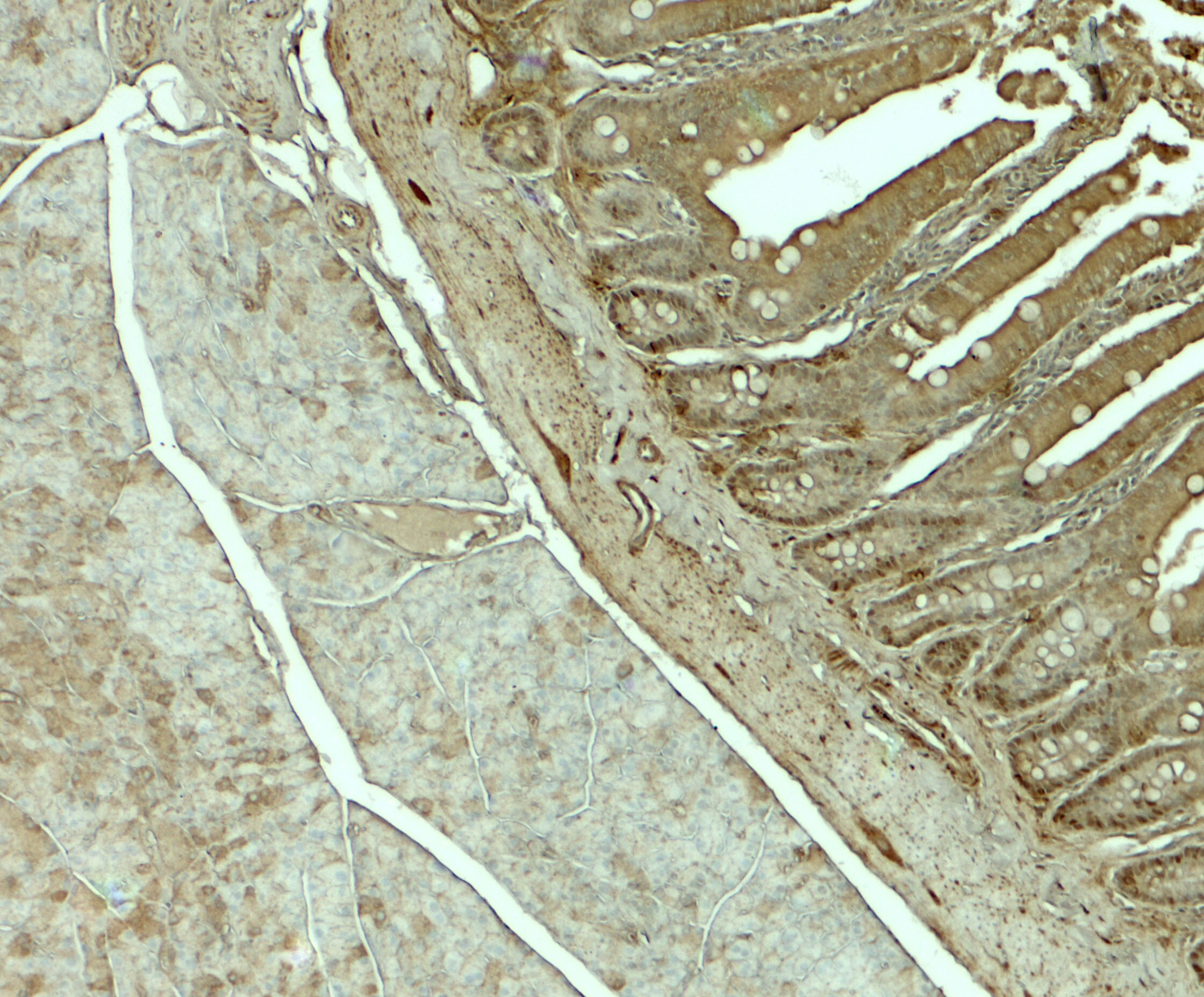 SLC29A3 Antibody - BSA Free