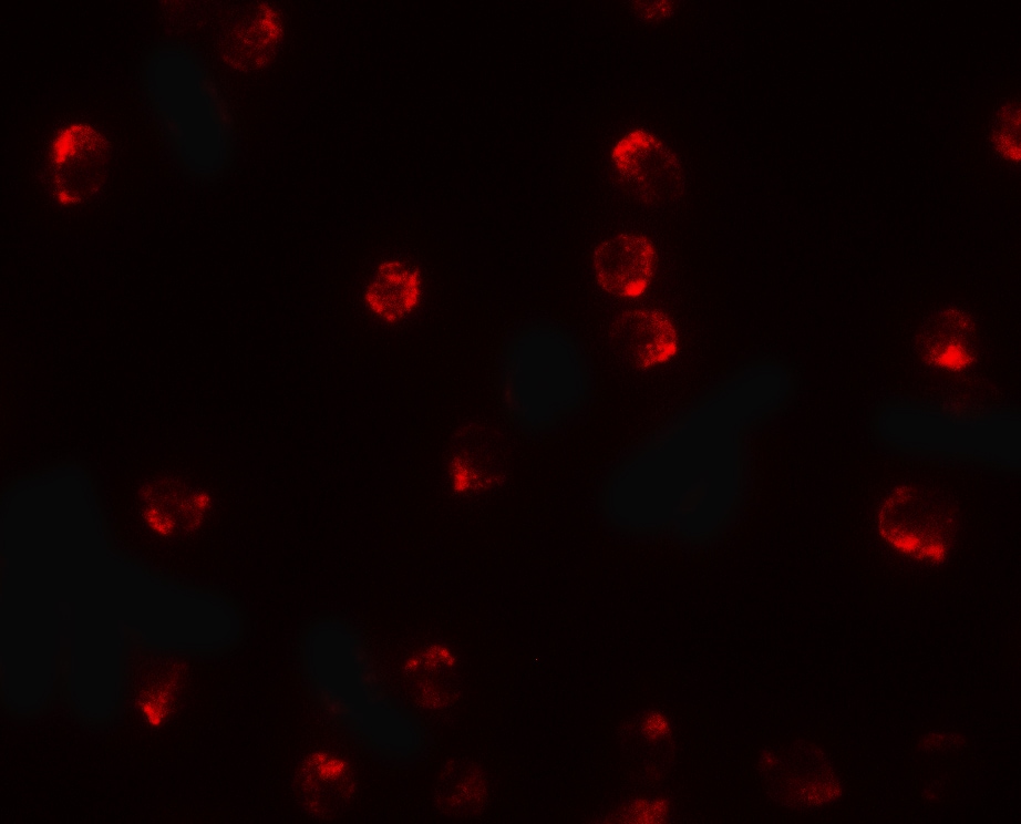 TCTEX1D2 Antibody - BSA Free