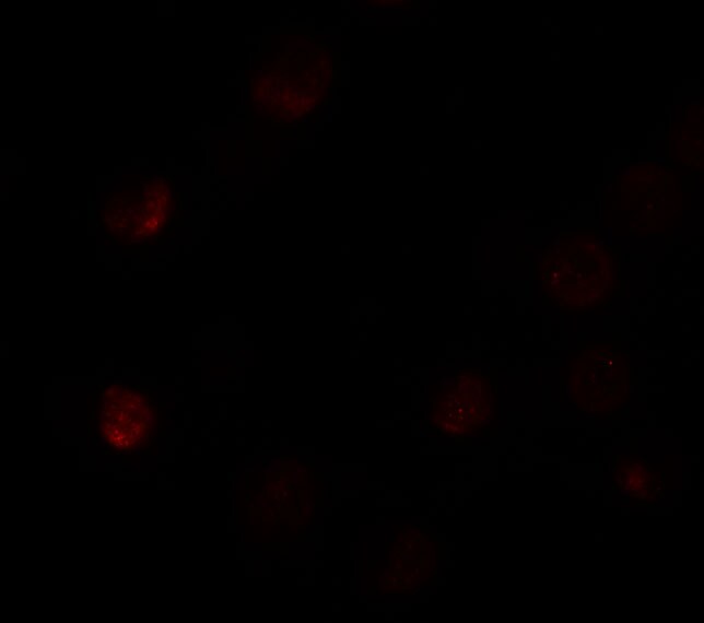 SLC35D3 Antibody - BSA Free