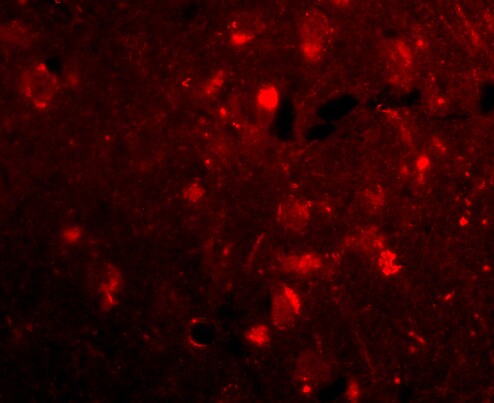 SLITRK2 Antibody - BSA Free