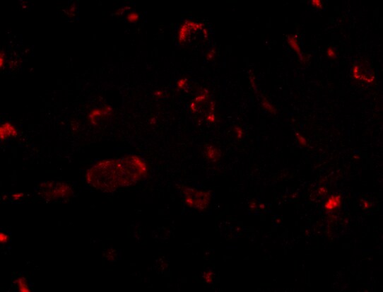 SLITRK2 Antibody - BSA Free
