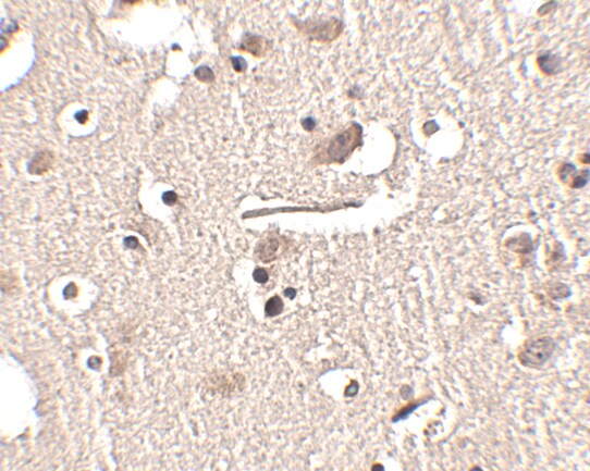 SLITRK2 Antibody - BSA Free