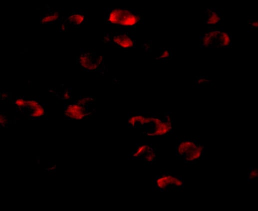 TMEM18 Antibody - BSA Free