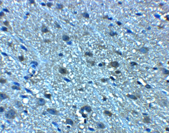 LANCL2 Antibody - BSA Free